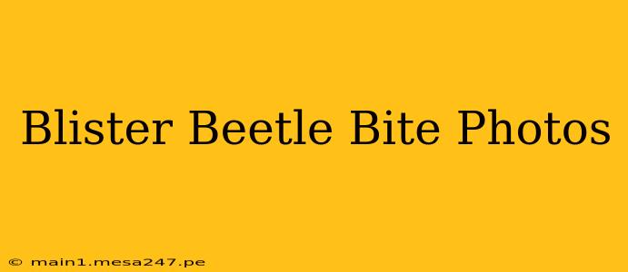 Blister Beetle Bite Photos