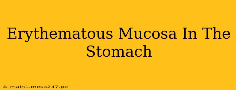 Erythematous Mucosa In The Stomach