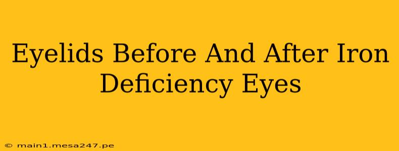 Eyelids Before And After Iron Deficiency Eyes