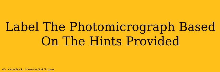 Label The Photomicrograph Based On The Hints Provided