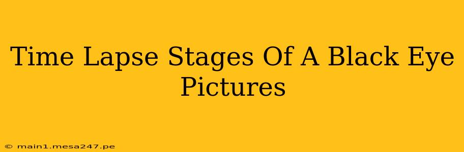 Time Lapse Stages Of A Black Eye Pictures